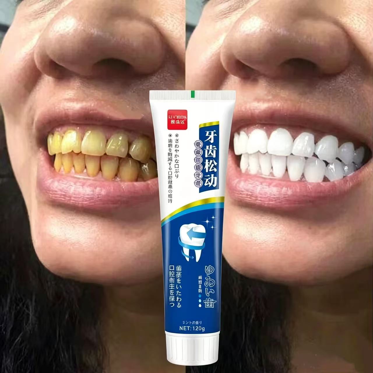 Teeth Whitening Japanese - Dentifricio Giapponese Importato per Denti Allentati,