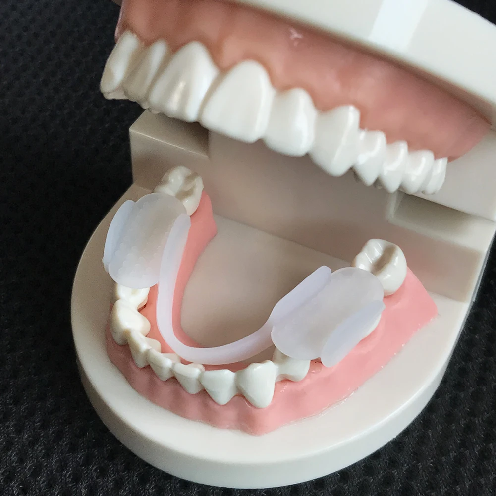 Dental Guard Night - 2 pezzi protezione per stecca per