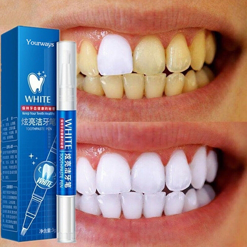 Gel sbiancante per denti sbian - Teeth Whitening Gel Pen recensione e prezzo