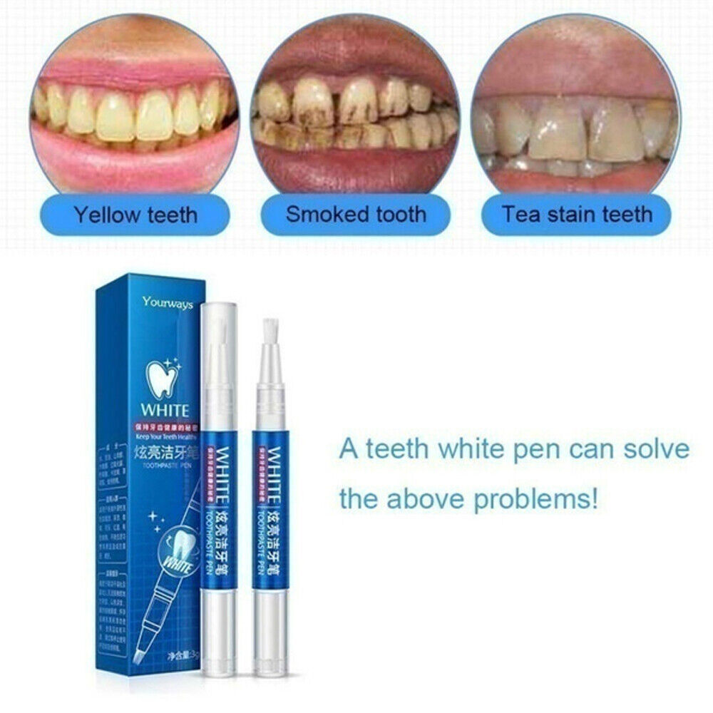 Gel sbiancante per denti sbian - Teeth Whitening Gel Pen recensione e prezzo