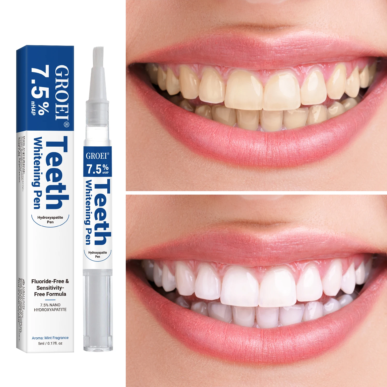 Penna per sbiancamento dei den - Teeth Whitening Gels Used By Dentists recensione e prezzo