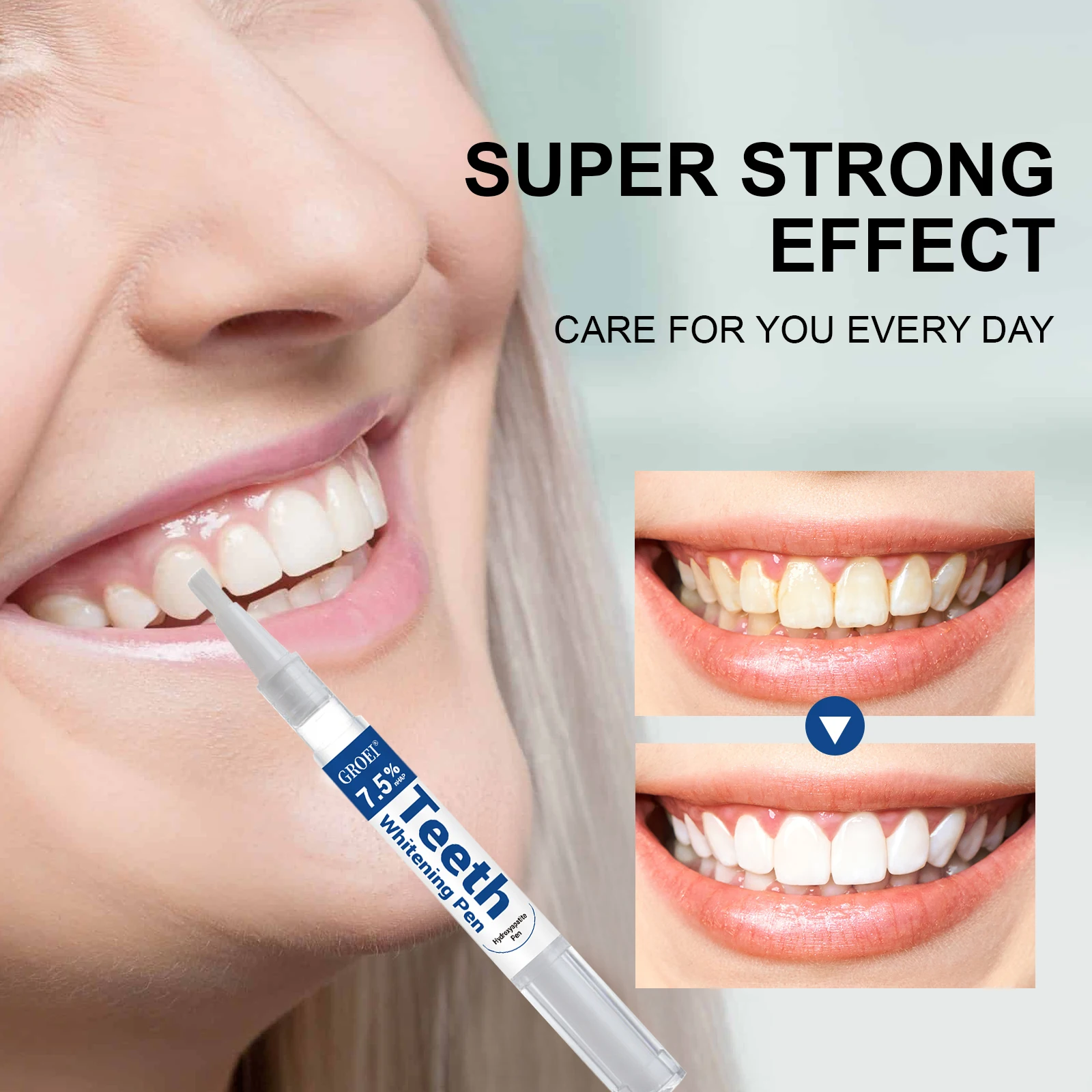 Penna per sbiancamento dei den - Teeth Whitening Gels Used By Dentists recensione e prezzo