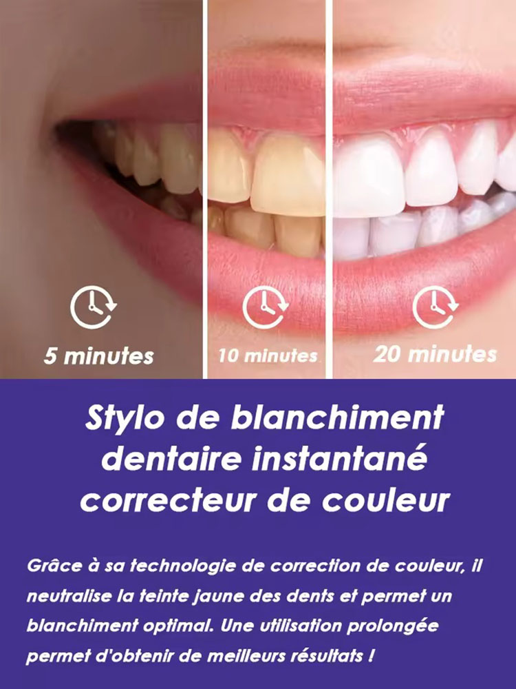Set di 2 Penne Sbiancanti per  - Teeth Whitening Gel Pen recensione e prezzo