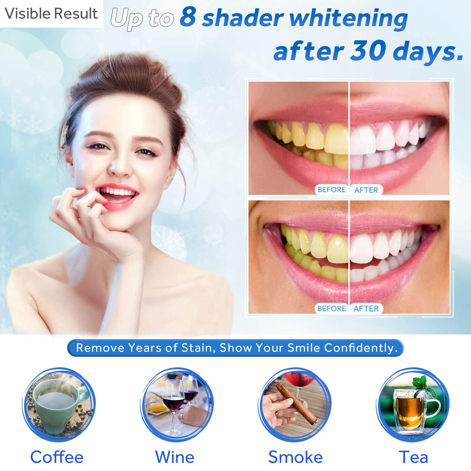 Gel sbiancante per denti Ricar - Teeth Whitening Gels Used By Dentists recensione e prezzo