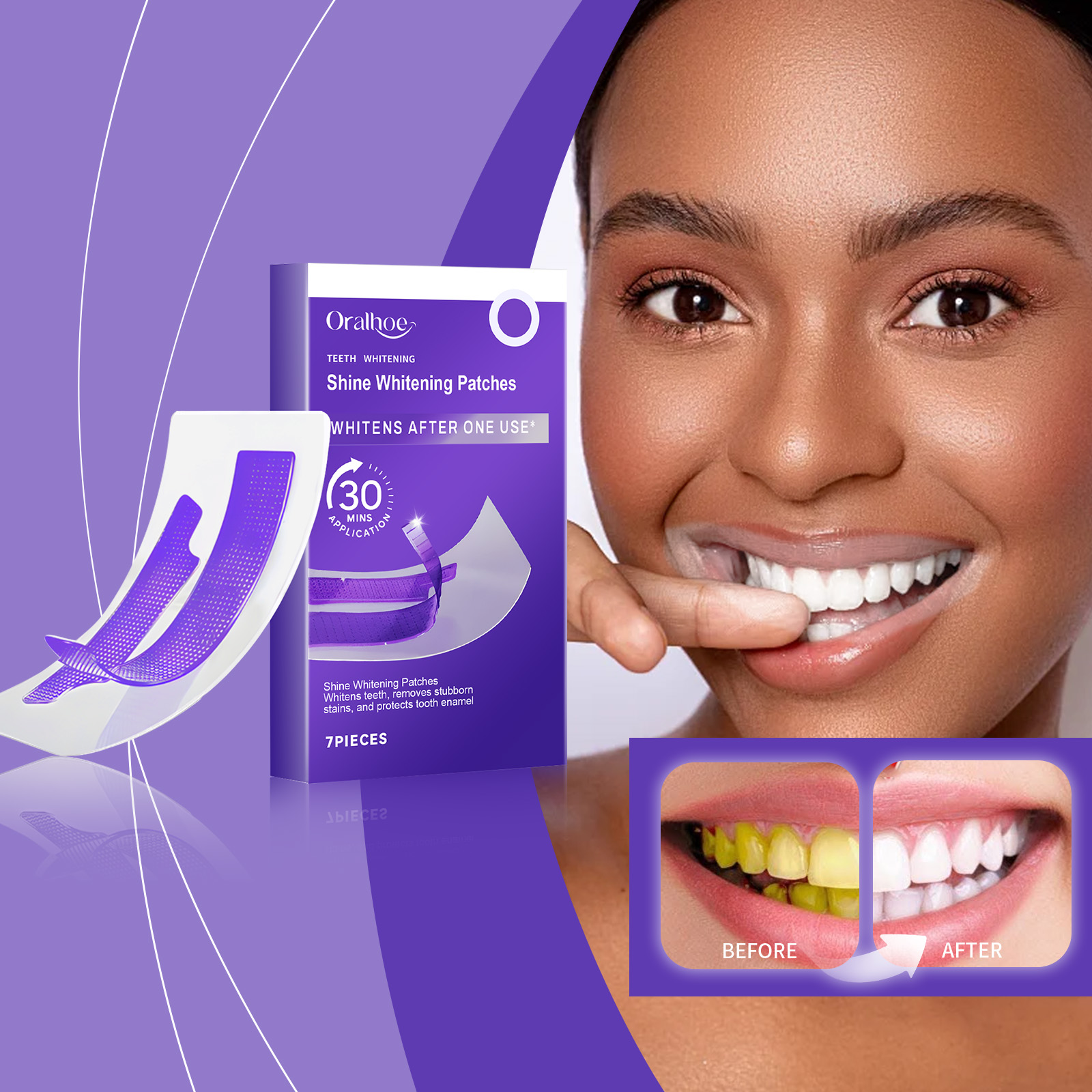 Strisce sbiancanti per denti v - Teeth Whitening Street recensione e prezzo