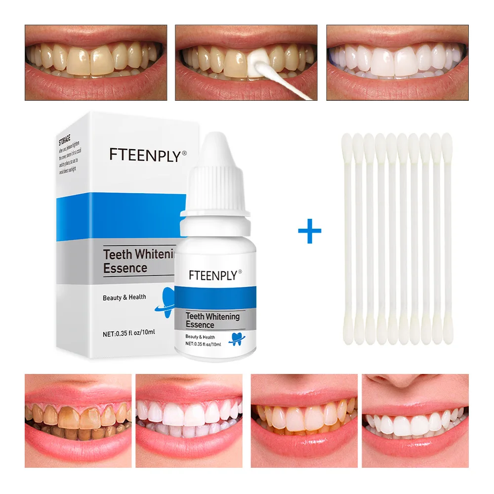 FTEENPLY Sbiancamento Dei Dent - Teeth Whitening Street recensione e prezzo