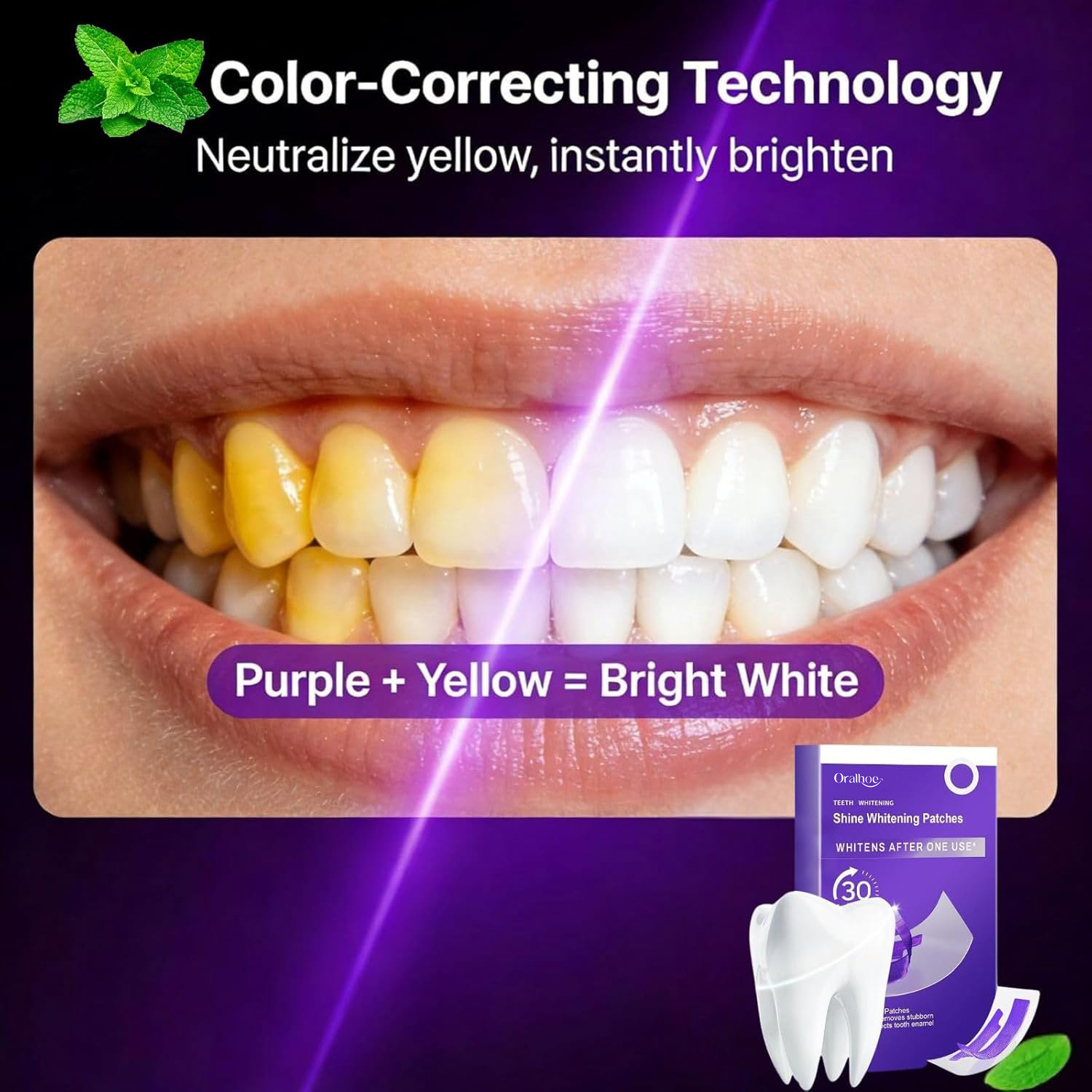 Kit Completo Sbiancante Denti  - Teeth Whitening Home Kit recensione e prezzo