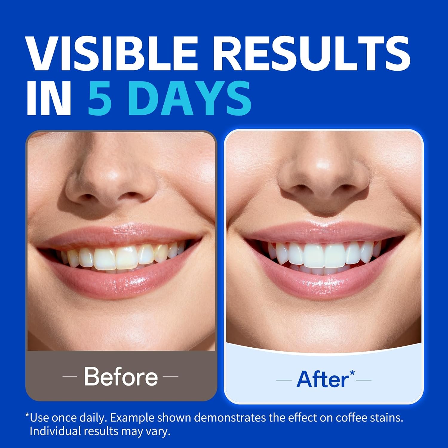 1/7 Paia di Strisce Sbiancanti - Teeth Whitening Street recensione e prezzo