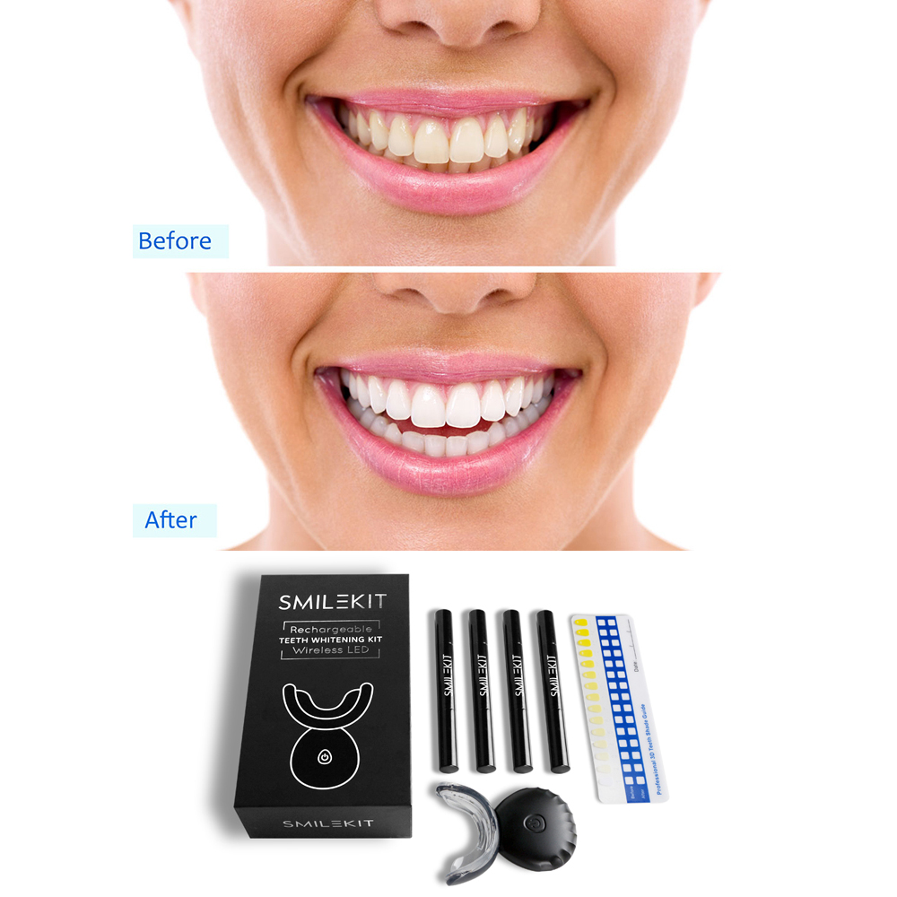 Nuovi kit di gel per sbiancame - Teeth Whitening Home Kit recensione e prezzo