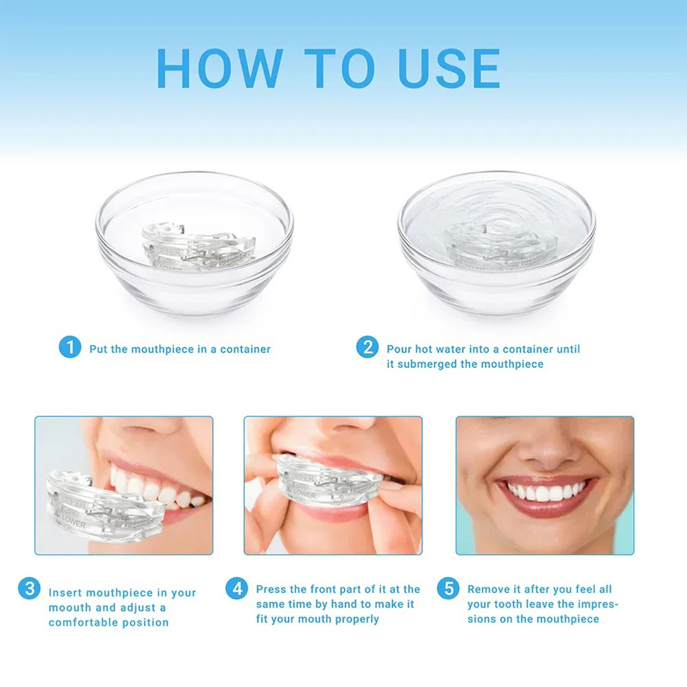 1/2/3/4/5 pezzi, denti anti-ru - Dental Guard Night recensione e prezzo